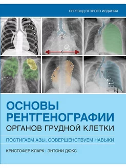 Основы рентгенографии органов грудной клетки