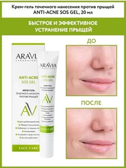 Крем-гель точечного нанесения против прыщей Anti-Acne SOS