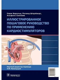 Иллюстрированное руководство по применению кардиостимулятора